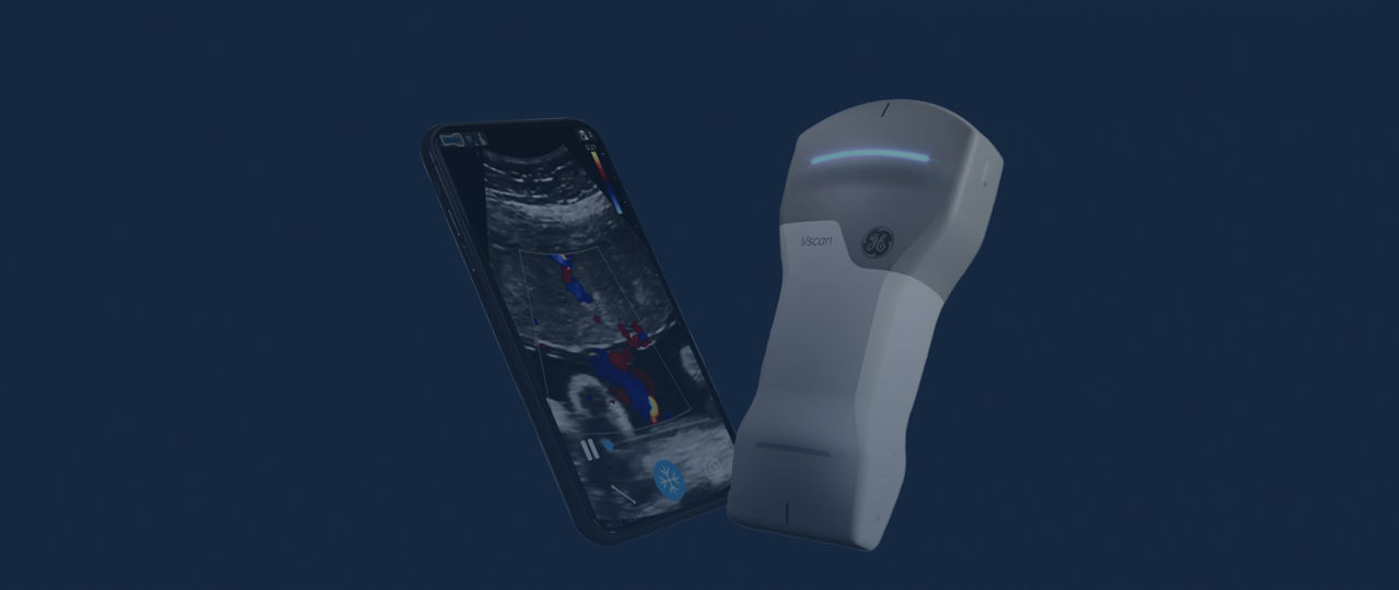 Handheld ultrasound equipment showcasing digital scan on smartphone
