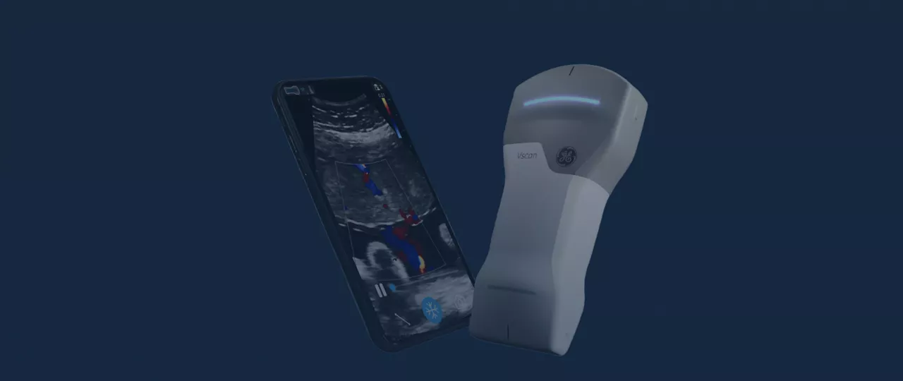 Handheld ultrasound equipment showcasing digital scan on smartphone