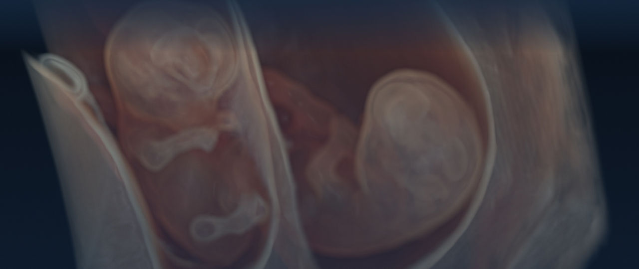 gehc-specialtiesLanding-obsGyn-storyCarousel-L01