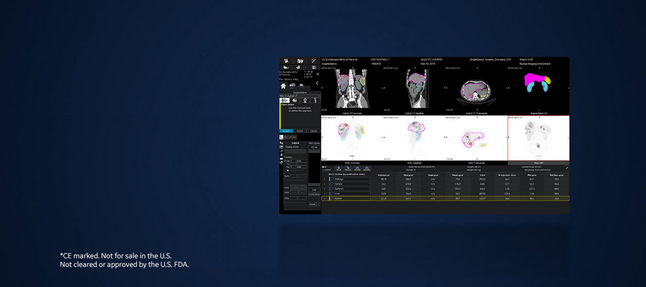 GEHC Xeleris V Product Web Page Overview Image 3v4