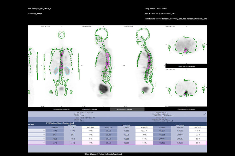GEHC870CZTQuantitativeApplicationsImage2v1
