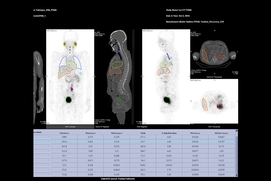 GEHC870CZTQuantitativeApplicationsImage3v1