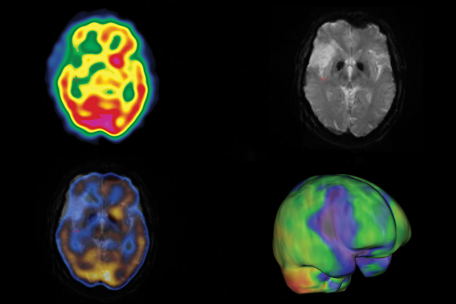 GEHC870CZTQuantitativeApplicationsImage4v1