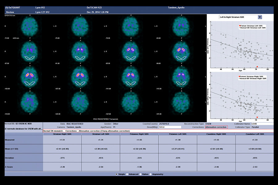 GEHC870CZTQuantitativeApplicationsImage5v1