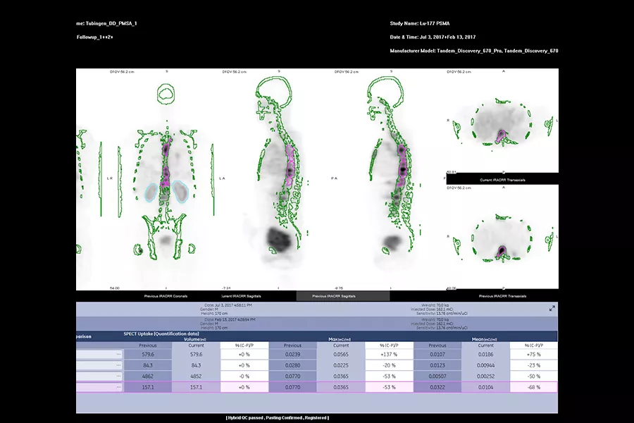 GEHC870CZTQuantitativeApplicationsImage2v1