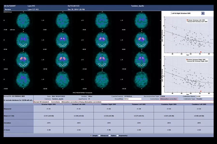 GEHC870CZTQuantitativeApplicationsImage5v1