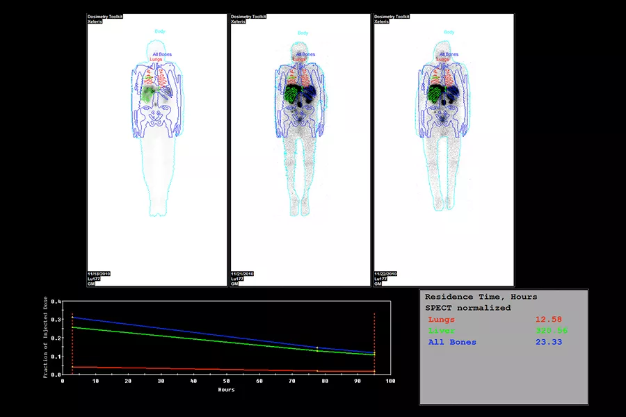 GEHC870CZTQuantitativeApplicationsImage8v1
