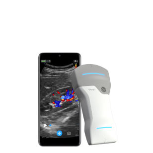 gehc_hp_pf02_ultrasound_DTM