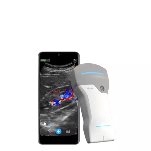 gehc_hp_pf02_ultrasound_DTM