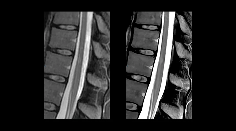 GEHCAIRImageQualityWebPageClinicalGalleryAIRReconDLImage2
