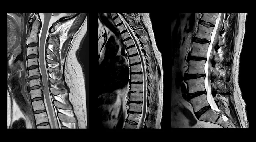 GEHCAIRImageQualityWebPageClinicalGalleryAIRReconDLImage4