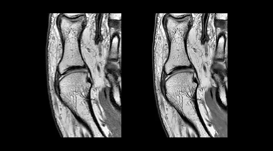 GEHCAIRImageQualityWebPageClinicalGalleryAIRReconDLImage6