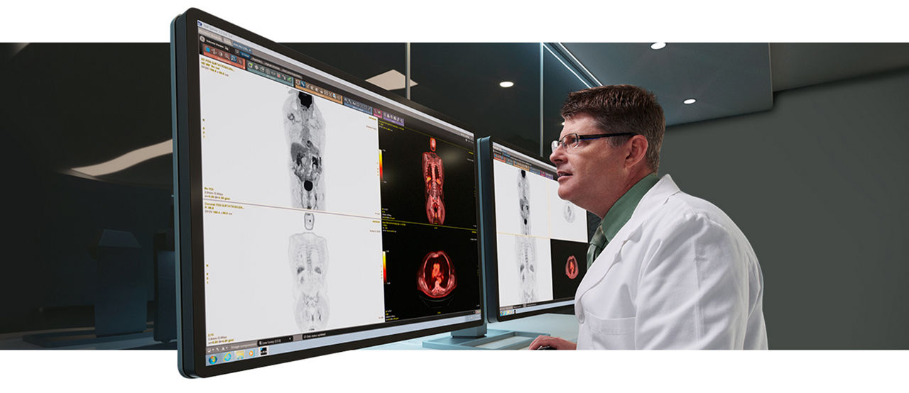 GEHC Discovery IQ Gen 2 Product Web Page Motion Correction Image 1