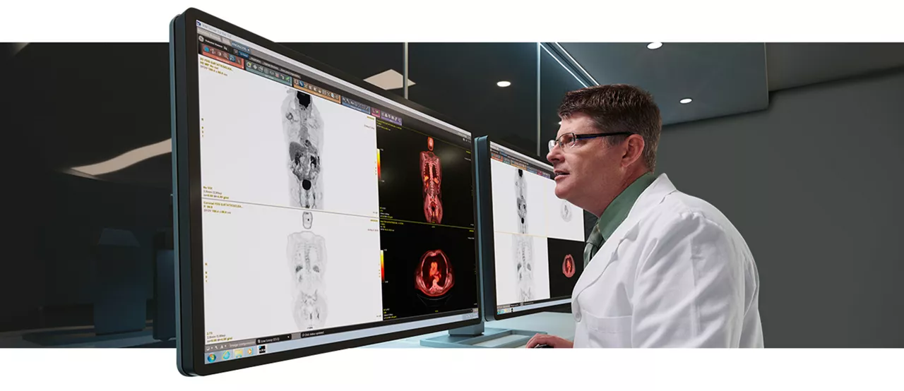 GEHC Discovery IQ Gen 2 Product Web Page Motion Correction Image 1
