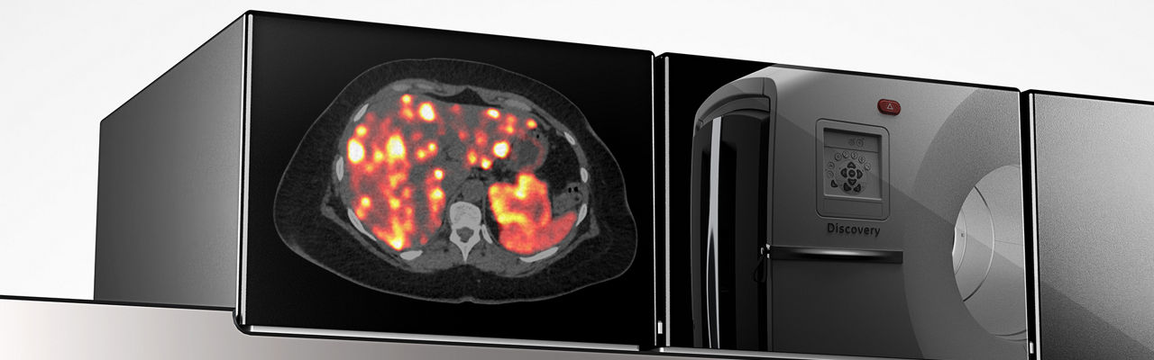 GEHCDMIG2ProductWebPageBenefitsSummaryImage1