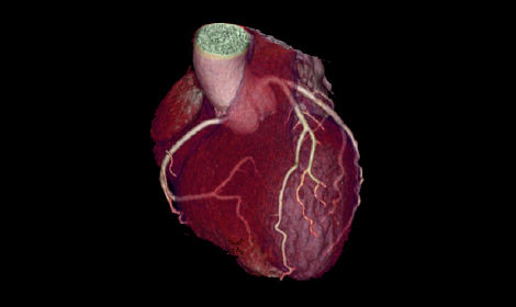 GEHCEffortlessWorkflowPost-scanImage2