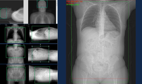 GEHCEffortlessWorkflowScanImage2