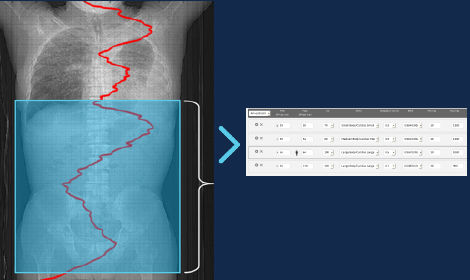 GEHCEffortlessWorkflowScanImage4