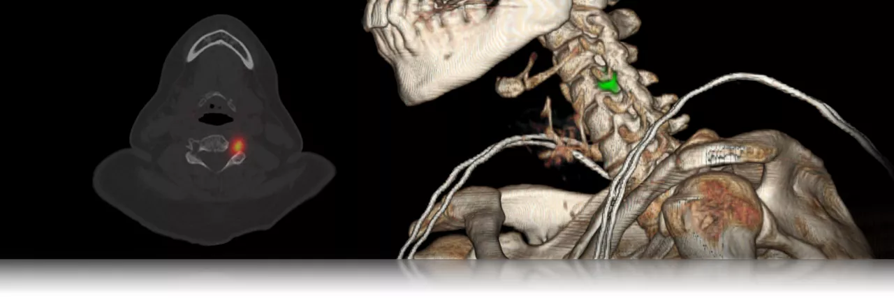 GEHCMILandingPageUpdatesNuclearMedicineImage1