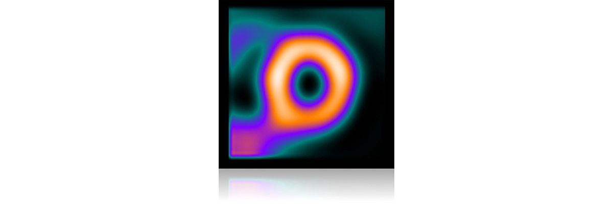 GEHCMyoSPECTPWPDesignImage3