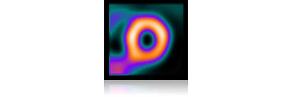 GEHCMyoSPECTPWPDesignImage3