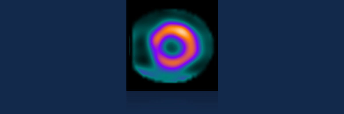 GEHCMyoSPECTPWPImageQualityImage2