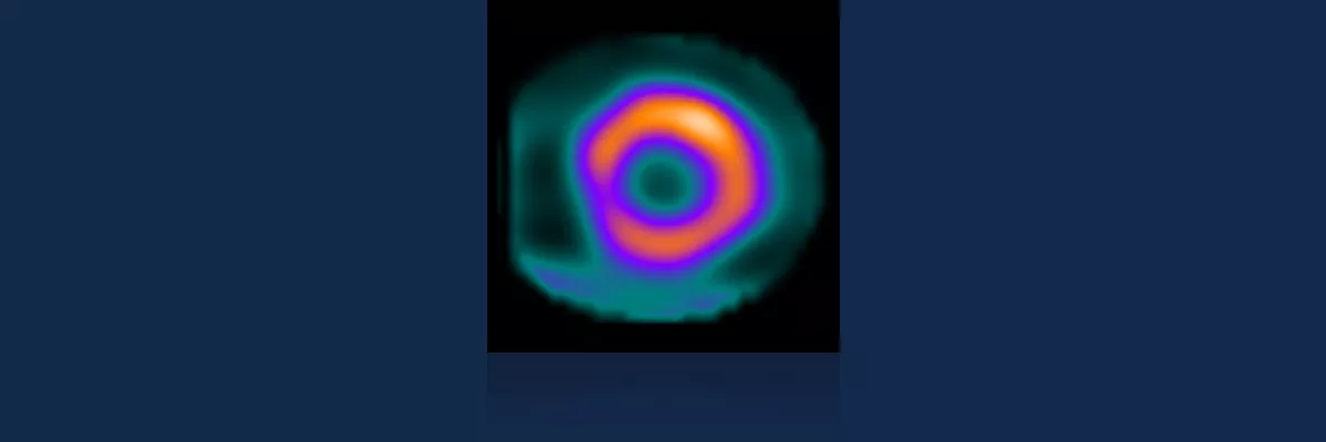 GEHCMyoSPECTPWPImageQualityImage2