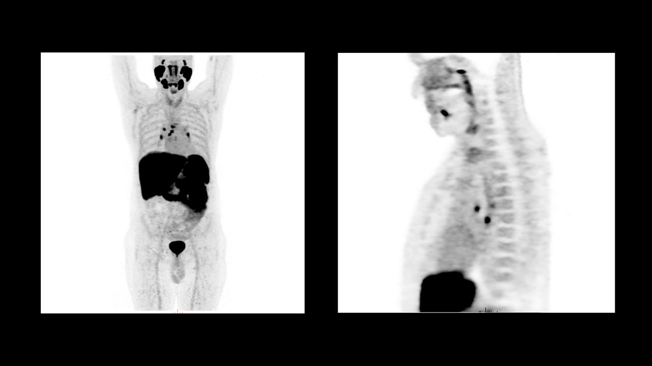 GEHCOmniLegendPWPCapabilityClinicalImage6Desktopv1