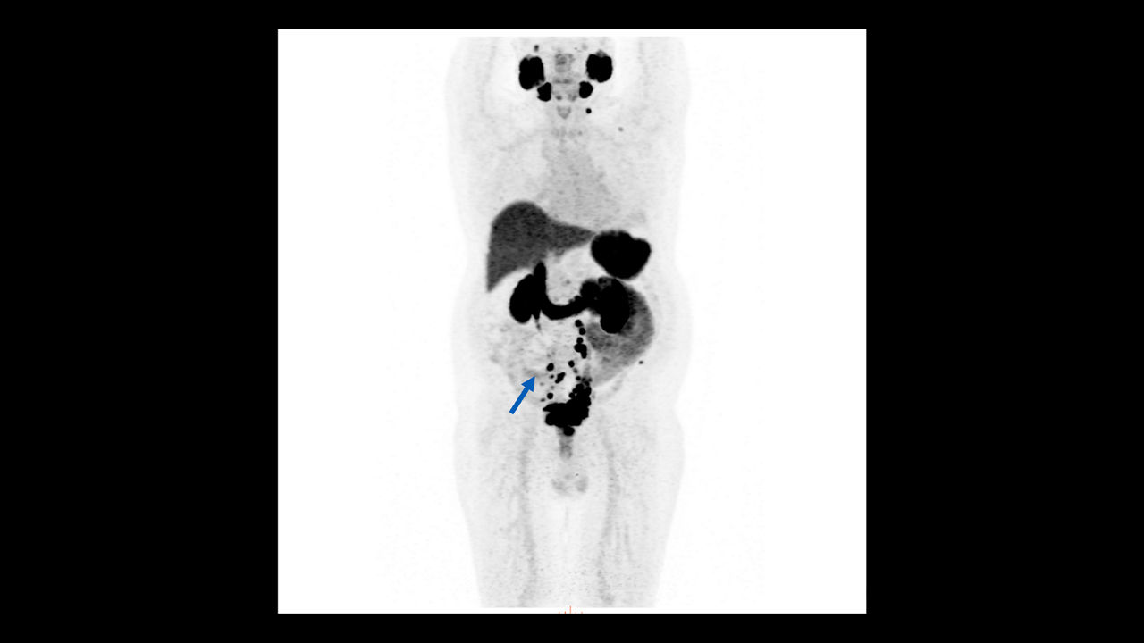 GEHCOmniLegendPWPCapabilityClinicalImage8Desktopv1