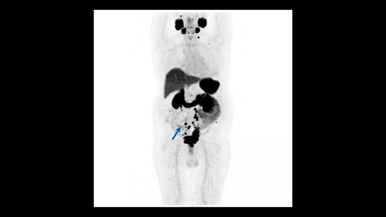 GEHCOmniLegendPWPCapabilityClinicalImage8Desktopv1