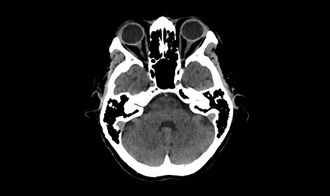 GEHCRevolutionAscendClinicalPerformanceImage2