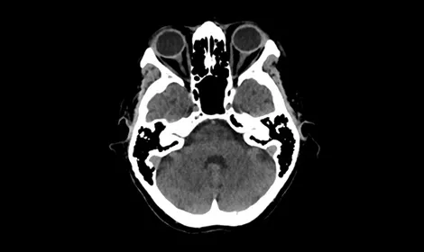 GEHCRevolutionAscendClinicalPerformanceImage2