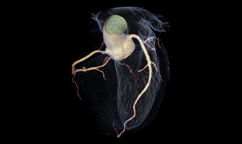 GEHCRevolutionAscendClinicalPerformanceImage3