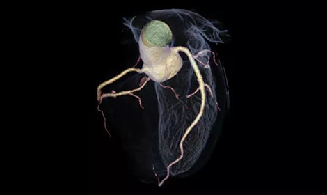 GEHCRevolutionAscendClinicalPerformanceImage3