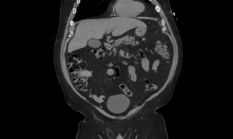 GEHCRevolutionAscendClinicalPerformanceImage4