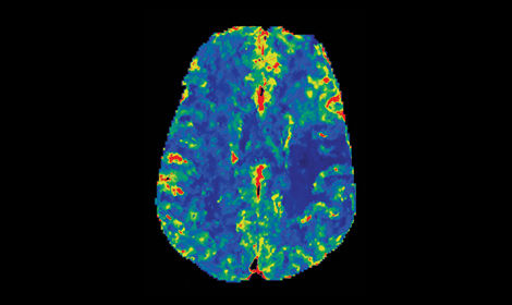 GEHCRevolutionAscendClinicalPerformanceImage5