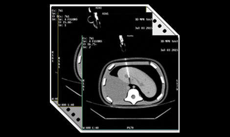 GEHCRevolutionAscendClinicalPerformanceImage6