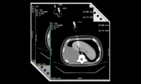 GEHCRevolutionAscendClinicalPerformanceImage6