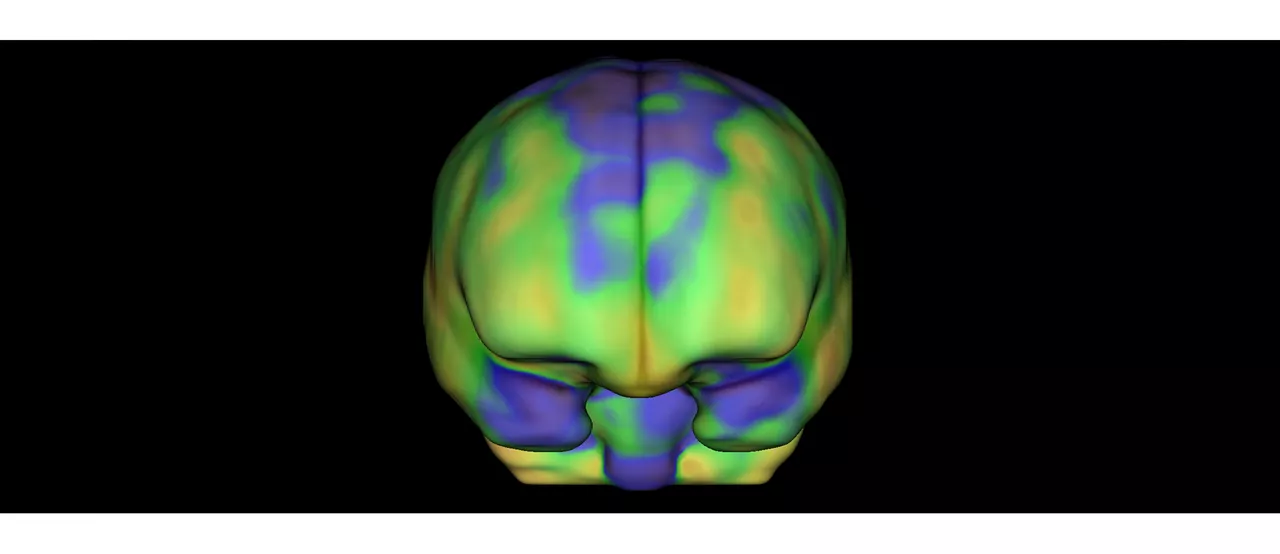 GEHCXeleris4DRQBrainImage1v1