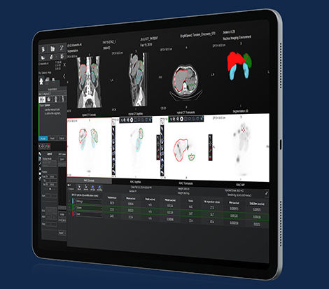 GEHCXelerisVProductWebPageClinicalApplicationsImage4