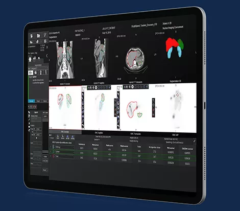 GEHCXelerisVProductWebPageClinicalApplicationsImage4