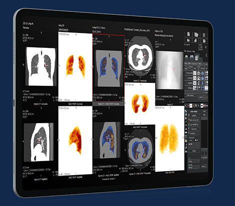 GEHCXelerisVProductWebPageClinicalApplicationsImage5