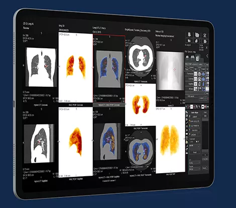 GEHCXelerisVProductWebPageClinicalApplicationsImage5