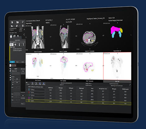 GEHCXelerisVProductWebPageClinicalApplicationsImage9