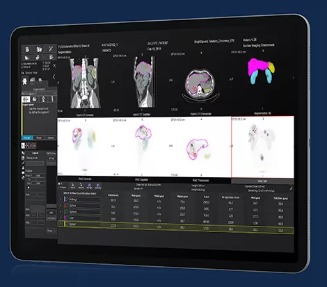 GEHCXelerisVProductWebPageClinicalApplicationsImage9