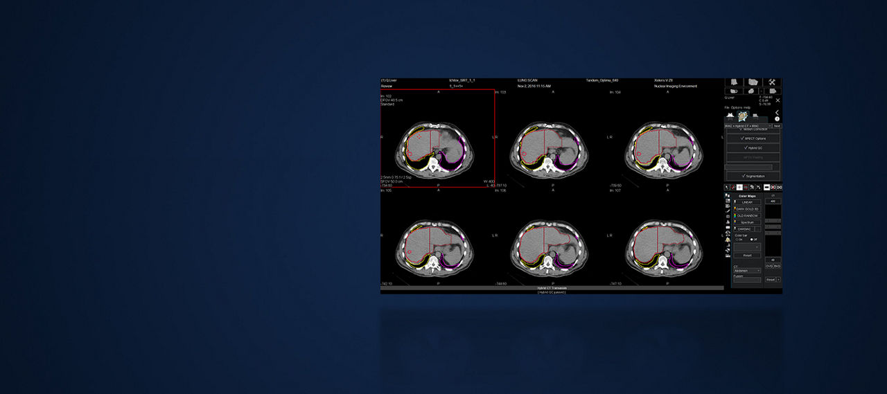 GEHCXelerisVProductWebPageOverviewImage5v2