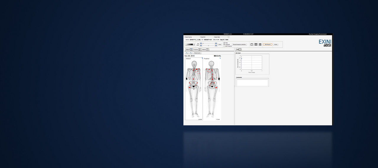 GEHCXelerisVProductWebPageOverviewImage6v2