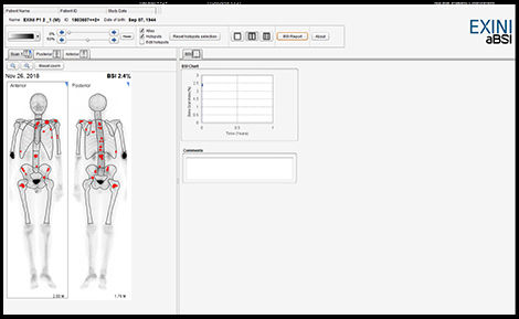GEHCXelerisVProductWebPageThird-partyApplicationsImage5