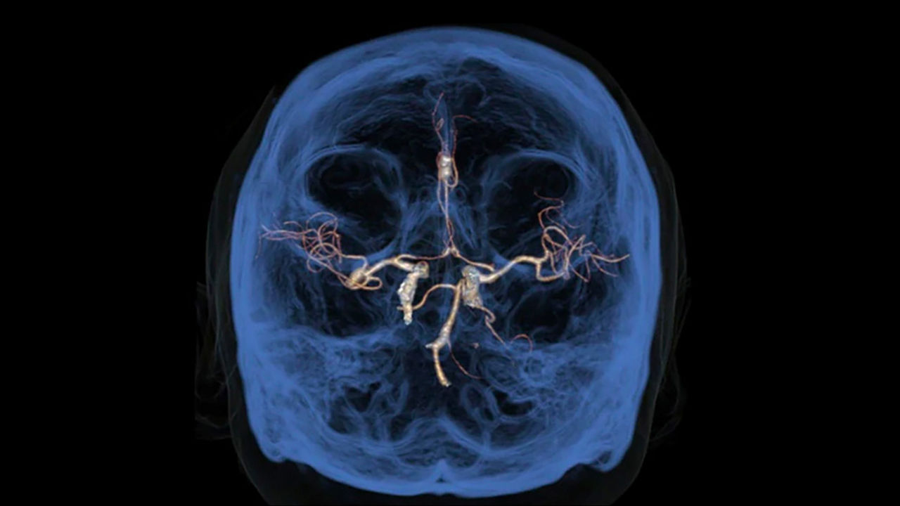 GEHEALTHCARE_CT_SmartSubscription_AdvancedVisualization_1920x1080