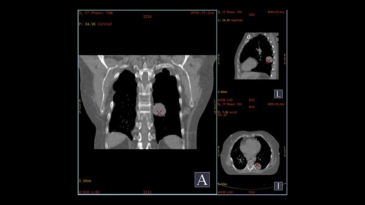GEHEALTHCARE_CT_SmartSubscription_Advantage4D_1920x1080
